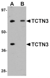 Western blot - TCTN3 Antibody from Signalway Antibody (25150) - Antibodies.com