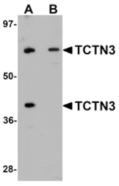 Western blot - TCTN3 Antibody from Signalway Antibody (25150) - Antibodies.com