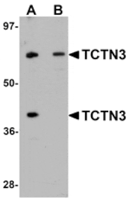 Western blot - TCTN3 Antibody from Signalway Antibody (25150) - Antibodies.com