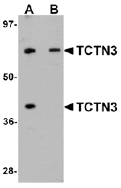 Western blot - TCTN3 Antibody from Signalway Antibody (25150) - Antibodies.com