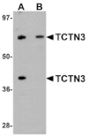 Western blot - TCTN3 Antibody from Signalway Antibody (25150) - Antibodies.com