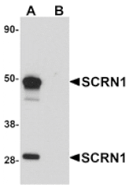 Western blot - SCRN1 Antibody from Signalway Antibody (25154) - Antibodies.com