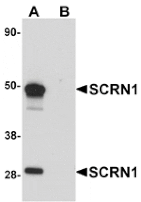 Western blot - SCRN1 Antibody from Signalway Antibody (25154) - Antibodies.com