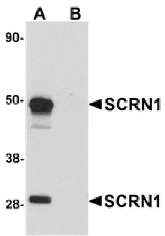 Western blot - SCRN1 Antibody from Signalway Antibody (25154) - Antibodies.com