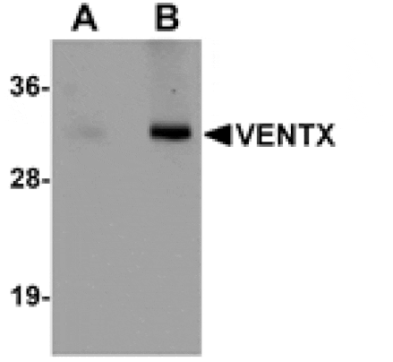 Western blot - VENTX Antibody from Signalway Antibody (25161) - Antibodies.com