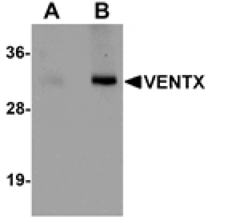 Western blot - VENTX Antibody from Signalway Antibody (25161) - Antibodies.com