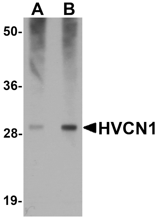 Western blot - HVCN1 Antibody from Signalway Antibody (25166) - Antibodies.com