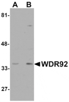 Western blot - WDR92 Antibody from Signalway Antibody (25170) - Antibodies.com