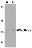Western blot - WDR92 Antibody from Signalway Antibody (25170) - Antibodies.com