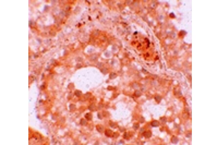 Immunohistochemistry - WDR92 Antibody from Signalway Antibody (25170) - Antibodies.com