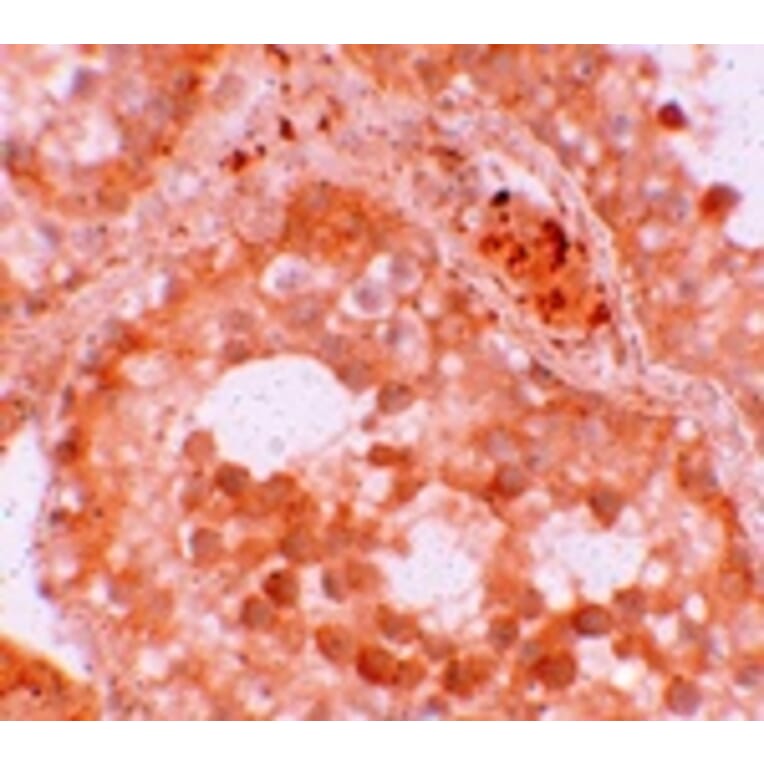 Immunohistochemistry - WDR92 Antibody from Signalway Antibody (25170) - Antibodies.com