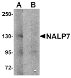 Western blot - NALP7 Antibody from Signalway Antibody (25182) - Antibodies.com