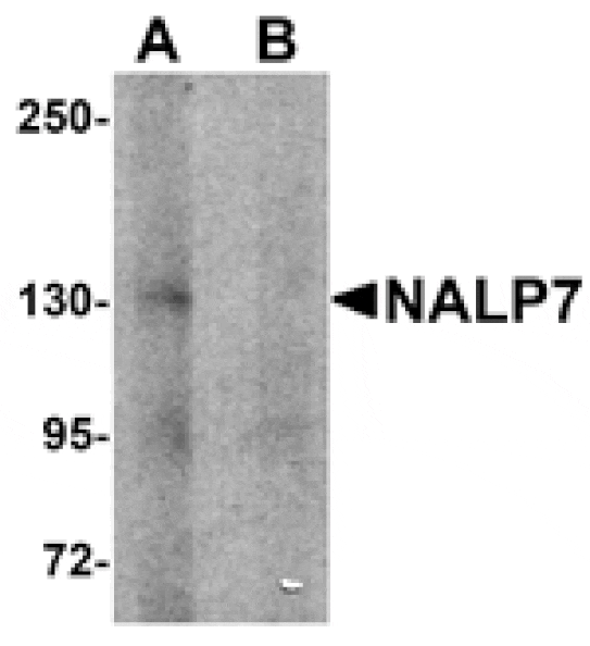 Western blot - NALP7 Antibody from Signalway Antibody (25182) - Antibodies.com