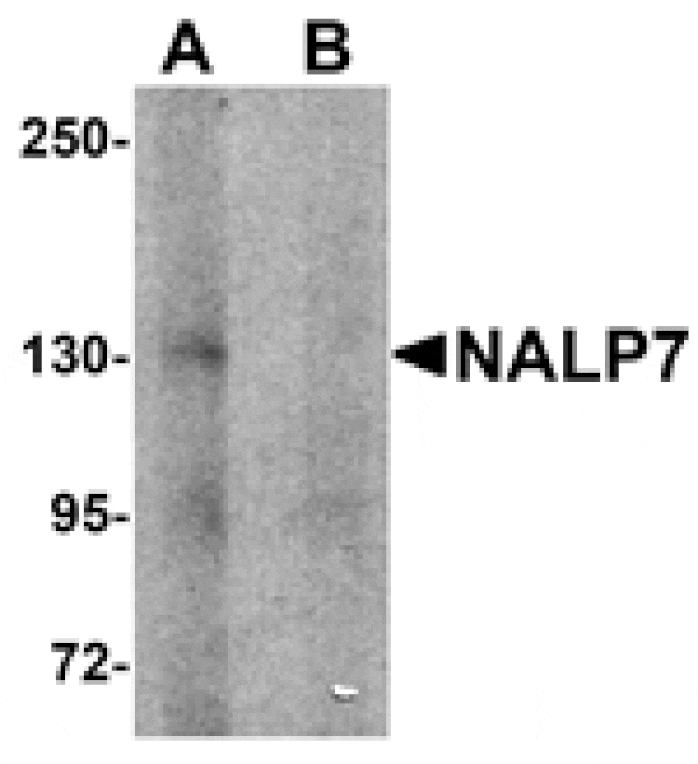 Western blot - NALP7 Antibody from Signalway Antibody (25182) - Antibodies.com