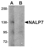 Western blot - NALP7 Antibody from Signalway Antibody (25182) - Antibodies.com