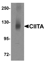 Western blot analysis of CIITA in mouse brain tissue lysate with CIITA antibody at 1 µg/mL.