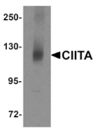 Western blot - CIITA Antibody from Signalway Antibody (25190) - Antibodies.com
