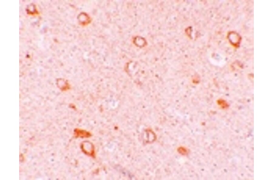 Immunohistochemistry - CIITA Antibody from Signalway Antibody (25190) - Antibodies.com