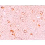 Immunohistochemistry - CIITA Antibody from Signalway Antibody (25190) - Antibodies.com