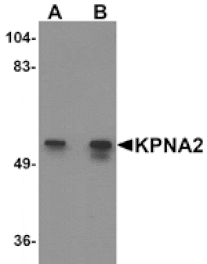 Western blot - KPNA2 Antibody from Signalway Antibody (25192) - Antibodies.com