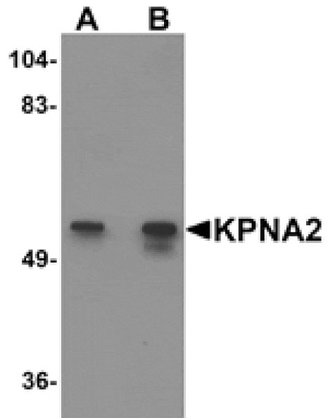 Western blot - KPNA2 Antibody from Signalway Antibody (25192) - Antibodies.com