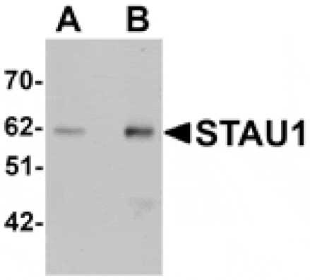 Western blot - STAU1 Antibody from Signalway Antibody (25197) - Antibodies.com