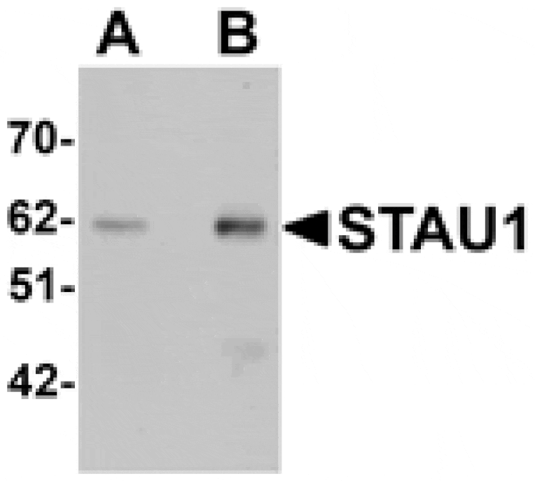 Western blot - STAU1 Antibody from Signalway Antibody (25197) - Antibodies.com