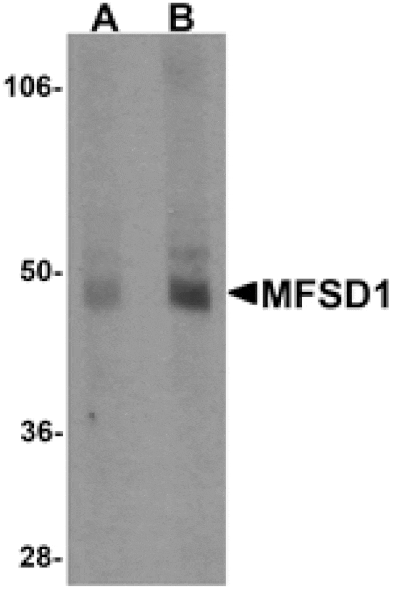 Western blot - MFSD1 Antibody from Signalway Antibody (25207) - Antibodies.com
