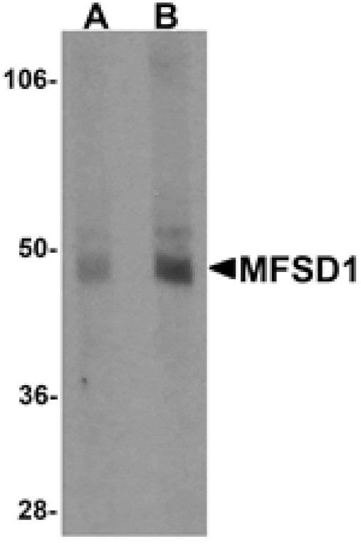 Western blot - MFSD1 Antibody from Signalway Antibody (25207) - Antibodies.com
