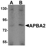 Western blot analysis of APBA2 in human brain tissue lysate with APBA2 antibody at (A) 1 and (B) 2 µg/mL.