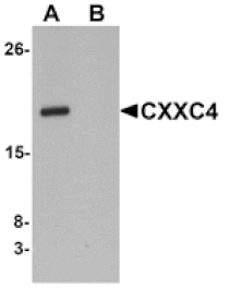 Western blot - CXXC4 Antibody from Signalway Antibody (25213) - Antibodies.com