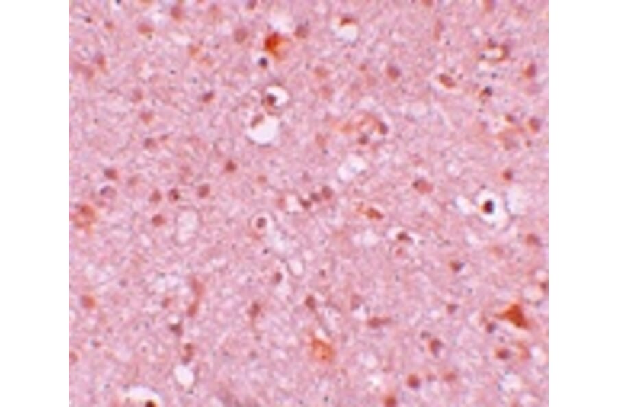 Immunohistochemistry - CXXC4 Antibody from Signalway Antibody (25213) - Antibodies.com