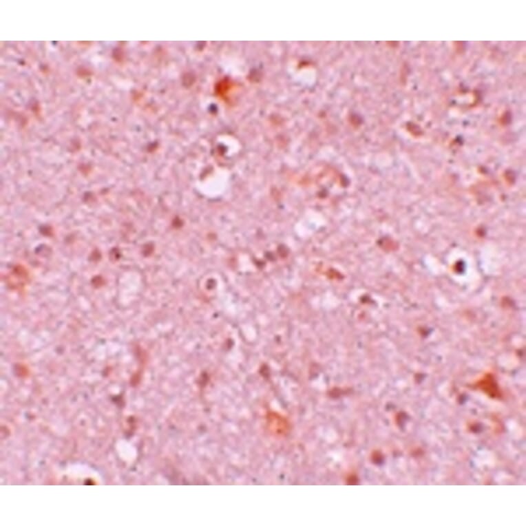Immunohistochemistry - CXXC4 Antibody from Signalway Antibody (25213) - Antibodies.com