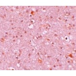 Immunohistochemistry - CXXC4 Antibody from Signalway Antibody (25213) - Antibodies.com