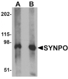 Western blot - SYNPO Antibody from Signalway Antibody (25217) - Antibodies.com