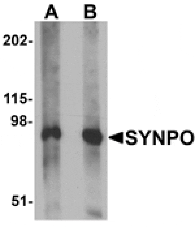 Western blot - SYNPO Antibody from Signalway Antibody (25217) - Antibodies.com