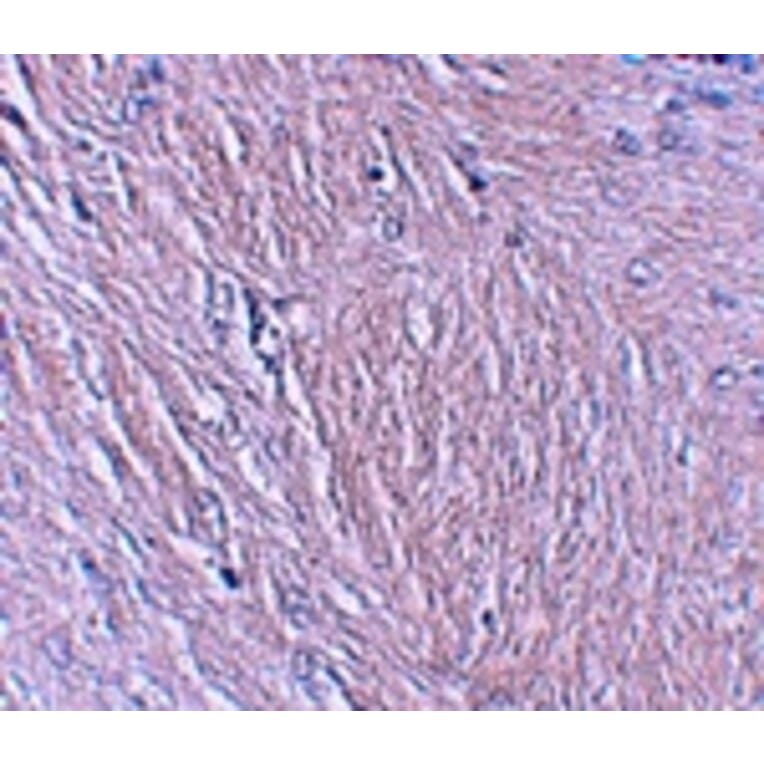 Immunohistochemistry - SYNPO Antibody from Signalway Antibody (25217) - Antibodies.com