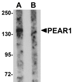 Western blot analysis of PEAR1 in rat kidney tissue lysate with PEAR1 antibody at 1 µg/mL in (A) the absence and (B) the presence of blocking peptide.