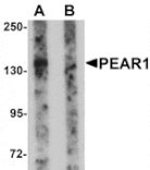 Western blot - PEAR1 Antibody from Signalway Antibody (25220) - Antibodies.com