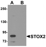 Western blot analysis of STOX2 in human kidney tissue lysate with STOX2 antibody at 1 µg/mL in (A) the absence and (B) the presence of blocking peptide.