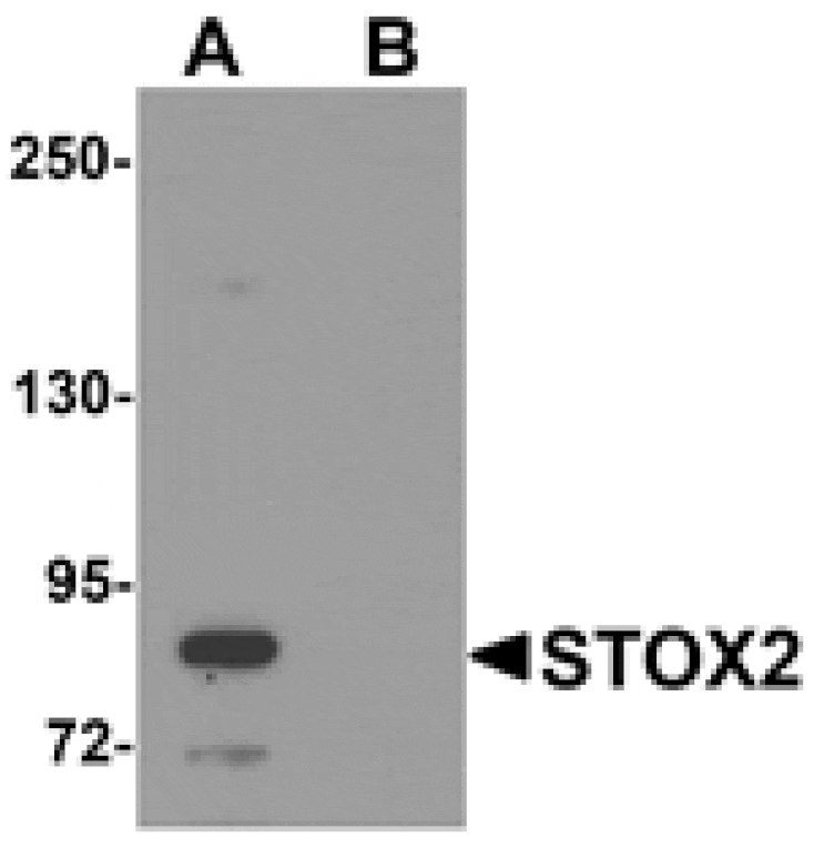 Western blot - STOX2 Antibody from Signalway Antibody (25222) - Antibodies.com