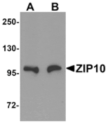 Western blot - ZIP10 Antibody from Signalway Antibody (25233) - Antibodies.com