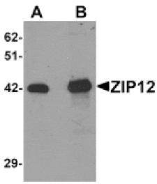 Western blot - ZIP12 Antibody from Signalway Antibody (25234) - Antibodies.com