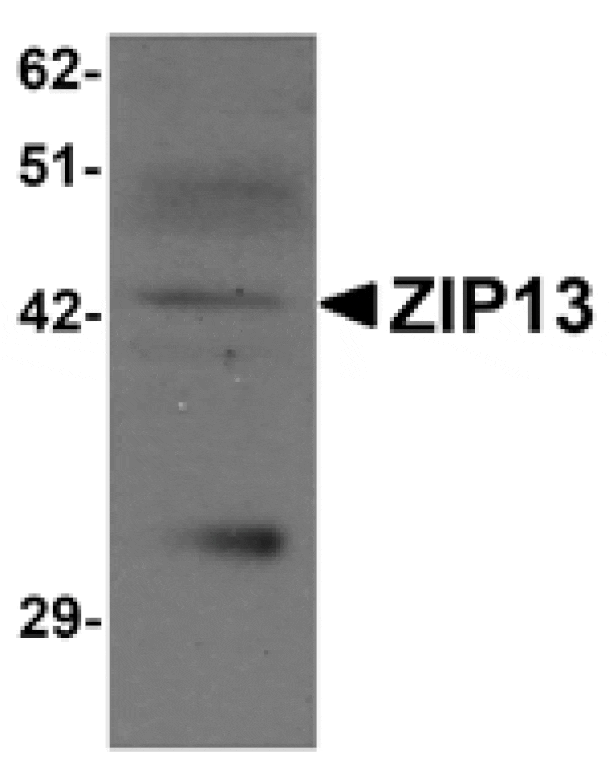Western blot - ZIP13 Antibody from Signalway Antibody (25235) - Antibodies.com