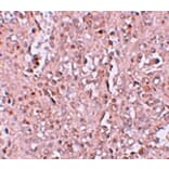 Immunohistochemistry - ZIP13 Antibody from Signalway Antibody (25235) - Antibodies.com
