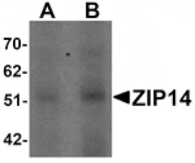 Western blot - ZIP14 Antibody from Signalway Antibody (25236) - Antibodies.com