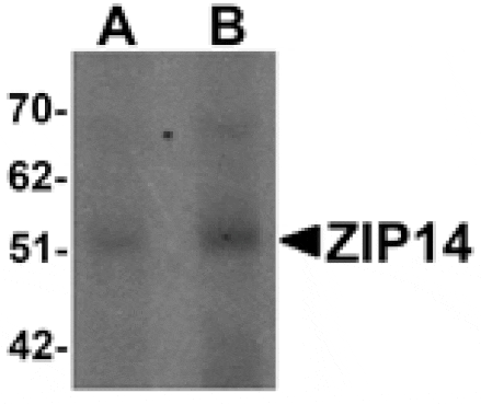 Western blot - ZIP14 Antibody from Signalway Antibody (25236) - Antibodies.com