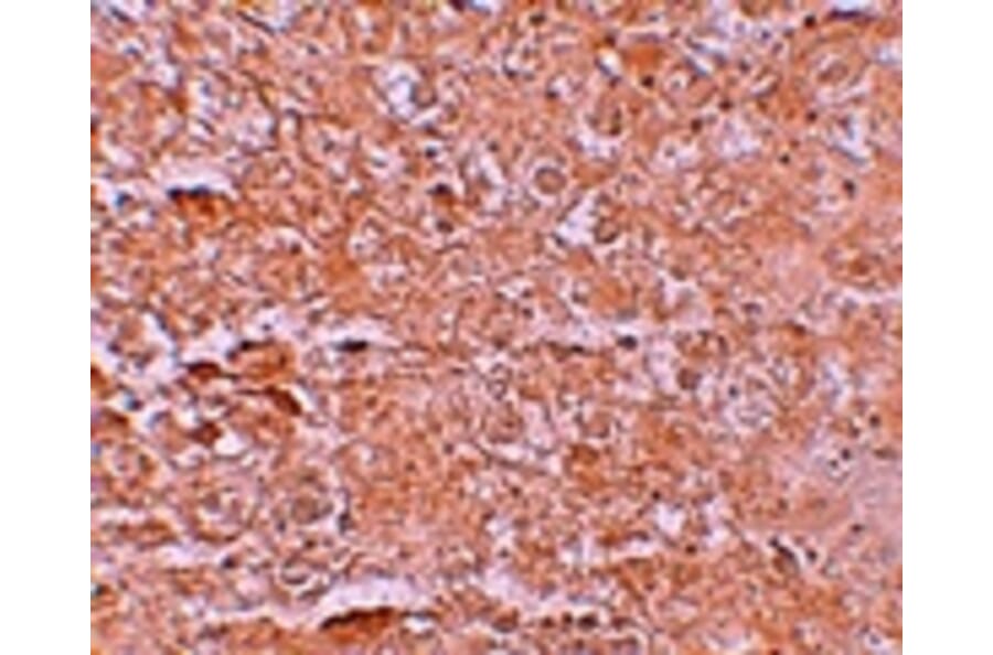 Immunohistochemistry - ZIP14 Antibody from Signalway Antibody (25236) - Antibodies.com