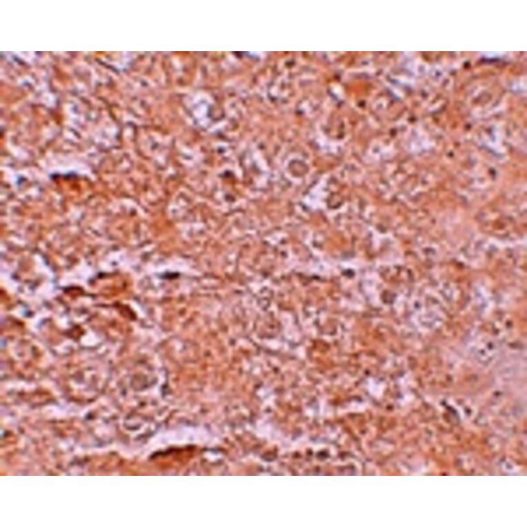 Immunohistochemistry - ZIP14 Antibody from Signalway Antibody (25236) - Antibodies.com