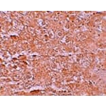 Immunohistochemistry - ZIP14 Antibody from Signalway Antibody (25236) - Antibodies.com